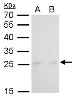 MAD2L1 Antibody (1761), Novus Biologicals 0.1mL; Unlabeled:Antibodies,