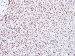 MAD2L1 Antibody, Novus Biologicals 0.1mg; Unlabeled:Antibodies, Polyclonal