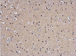 MAD2L1 Antibody, Novus Biologicals 0.1mg; Unlabeled:Antibodies, Polyclonal
