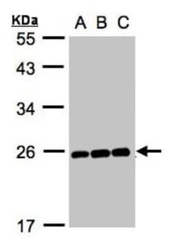 MAD2L1 Antibody, Novus Biologicals 0.1mg; Unlabeled:Antibodies, Polyclonal