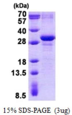 Novus Biologicals Recombinant Human MAD3 His Protein 0.1 mg | Buy Online | Novus Biologicals&trade; | Fisher Scientific