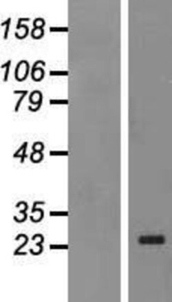 Novus Biologicals&trade;&nbsp;MAD4 Overexpression Lysate