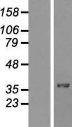 Novus Biologicals&trade;&nbsp;MafA Overexpression Lysate