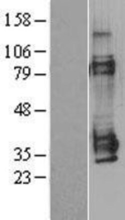 Novus Biologicals™ MAGEA1 Overexpression Lysate