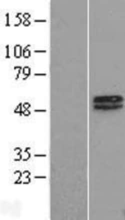 Novus Biologicals&trade;&nbsp;MAGEA10 Overexpression Lysate