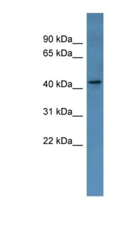MAGEA11 Antibody, Novus Biologicals:Antibodies:Primary Antibodies