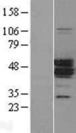 Novus Biologicals&trade;&nbsp;MAGEA11 Overexpression Lysate