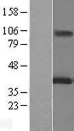 Novus Biologicals™ MAGEA12 Overexpression Lysate