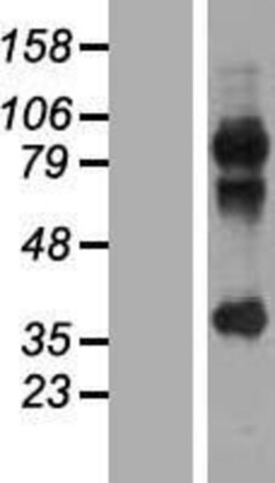 Novus Biologicals™ MAGEA2B Overexpression Lysate