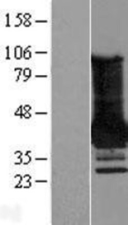 Novus Biologicals&trade;&nbsp;MAGEA4 Overexpression Lysate