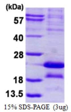 Novus Biologicals&trade;&nbsp;Recombinant Human MAGEA5 His Protein