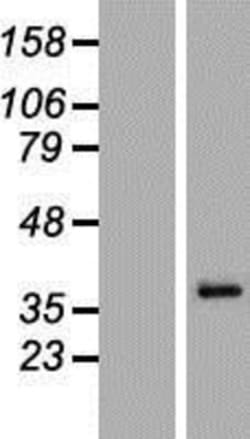 Novus Biologicals™ MAGEA6 Overexpression Lysate