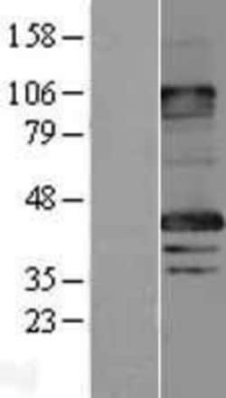 Novus Biologicals™ MAGEA8 Overexpression Lysate