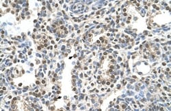 MAGEA8 Antibody, Novus Biologicals:Antibodies:Primary Antibodies