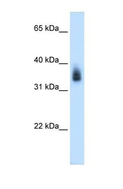 MAGEA8 Antibody, Novus Biologicals:Antibodies:Primary Antibodies