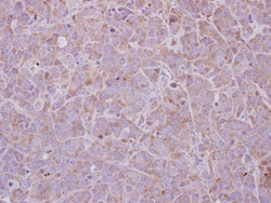 MAGEB1 Antibody, Novus Biologicals 0.1mL; Unlabeled:Antibodies, Polyclonal