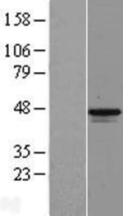 Novus Biologicals&trade;&nbsp;MAGEB1 Overexpression Lysate