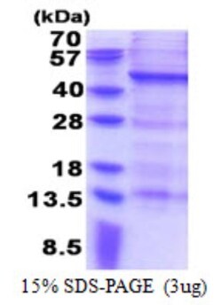 Novus Biologicals&trade;&nbsp;Recombinant Human MAGEB10 His Protein