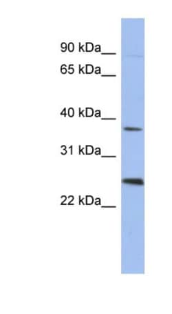 MAGEB2 Antibody, Novus Biologicals 100&mu;L; Unlabeled:Antibodies, Polyclonal