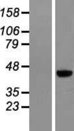 Novus Biologicals&trade;&nbsp;MAGEB6 Overexpression Lysate