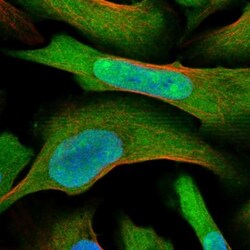 MAGED2 Antibody, Novus Biologicals 0.1mL; Unlabeled:Antibodies, Polyclonal