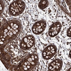 MAGED2 Antibody, Novus Biologicals 0.1mL; Unlabeled:Antibodies, Polyclonal