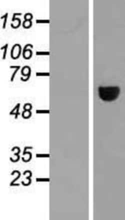 Novus Biologicals&trade;&nbsp;MAGEE2 Overexpression Lysate