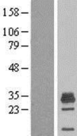 Novus Biologicals&trade;&nbsp;MAGEH1 Overexpression Lysate