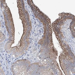 MAGI1 Antibody, Novus Biologicals:Antibodies:Primary Antibodies