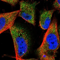 MAGIX Antibody, Novus Biologicals:Antibodies:Primary Antibodies