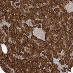 MAGIX Antibody, Novus Biologicals:Antibodies:Primary Antibodies