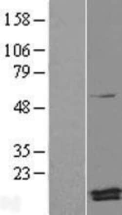 Novus Biologicals&trade;&nbsp;Magmas Overexpression Lysate