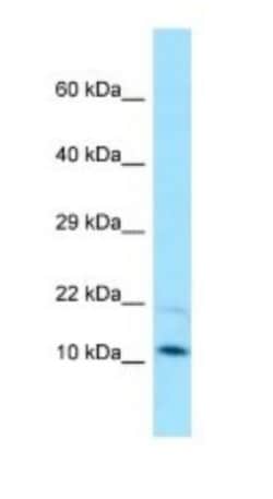 Magmas Antibody, Novus Biologicals 100 &mu;L | Buy Online | Novus Biologicals | Fisher Scientific