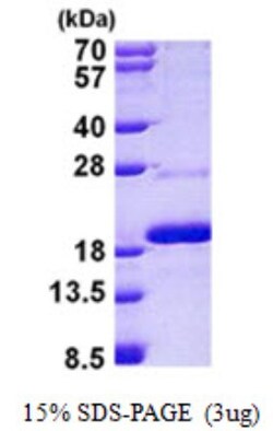 Novus Biologicals&trade;&nbsp;Recombinant Human Mago nashi homolog 2 His Protein