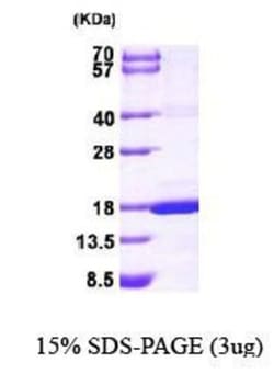 Novus Biologicals&trade;&nbsp;Recombinant Human MAGOH His Protein