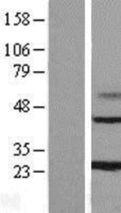 Novus Biologicals&trade;&nbsp;MAGP-1/MFAP2 Overexpression Lysate