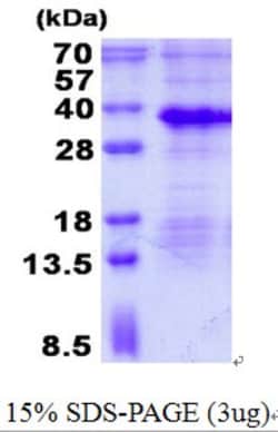 Novus Biologicals&trade;&nbsp;Recombinant Human MAGP-1/MFAP2 His Protein