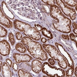 MAGT1 Antibody, Novus Biologicals 25ul | Buy Online | Novus Biologicals | Fisher Scientific