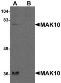 Novus Biologicals™ MAK10 Antibody Blocking Peptide