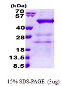 Novus Biologicals&trade;&nbsp;Recombinant Human MAK3 His Protein