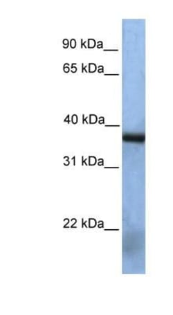 MAK3 Antibody, Novus Biologicals 100 &mu;L | Buy Online | Novus Biologicals | Fisher Scientific