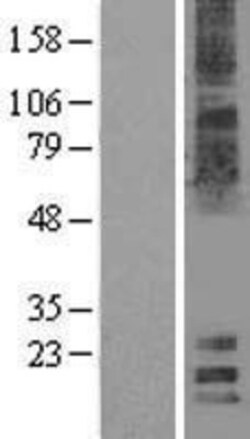 Novus Biologicals™ MAL2 Overexpression Lysate