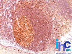MALT1 Antibody (MT1/410), Novus Biologicals:Antibodies:Primary Antibodies