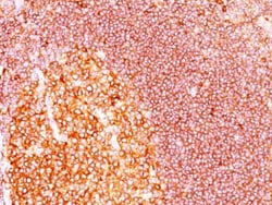 MALT1 Antibody (MT1/410), Novus Biologicals:Antibodies:Primary Antibodies