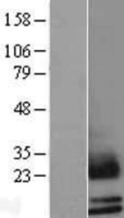 Novus Biologicals&trade;&nbsp;Mammaglobin B Overexpression Lysate
