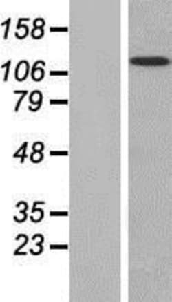 Novus Biologicals™ MAN2B2 Overexpression Lysate