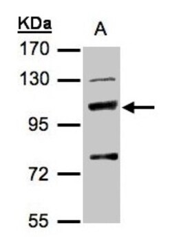 MANBA Antibody, Novus Biologicals 0.1mg; Unlabeled:Antibodies, Polyclonal