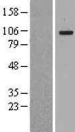 Novus Biologicals&trade;&nbsp;MANBA Overexpression Lysate