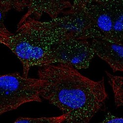 MANBA Antibody, Novus Biologicals 0.1mL; Unlabeled:Antibodies, Polyclonal