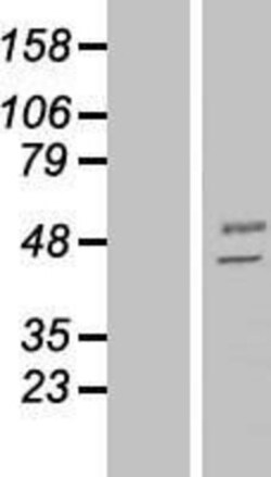 Novus Biologicals&trade;&nbsp;MANEA Overexpression Lysate
